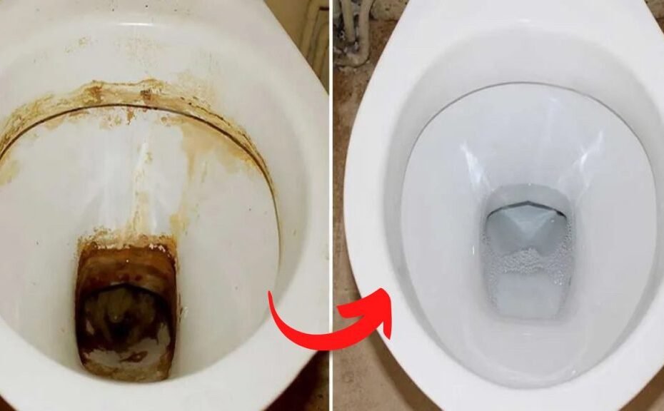 Cet ingrédient élimine les dépôts de calcaire les plus tenaces dans les toilettes