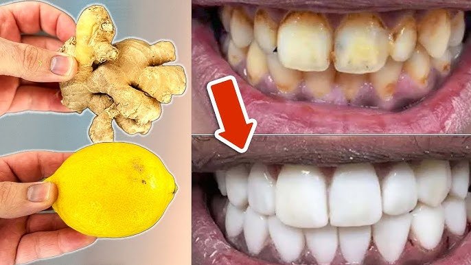 Dents plus propres et sourire plus lumineux : remède maison simple en 2 minutes