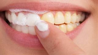 Dents plus propres et sourire plus lumineux en 2 minutes : attention aux promesses miracles