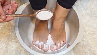 J&rsquo;ai mis du bicarbonate de soude sur mes pieds et regardez ce qui s&rsquo;est passé !